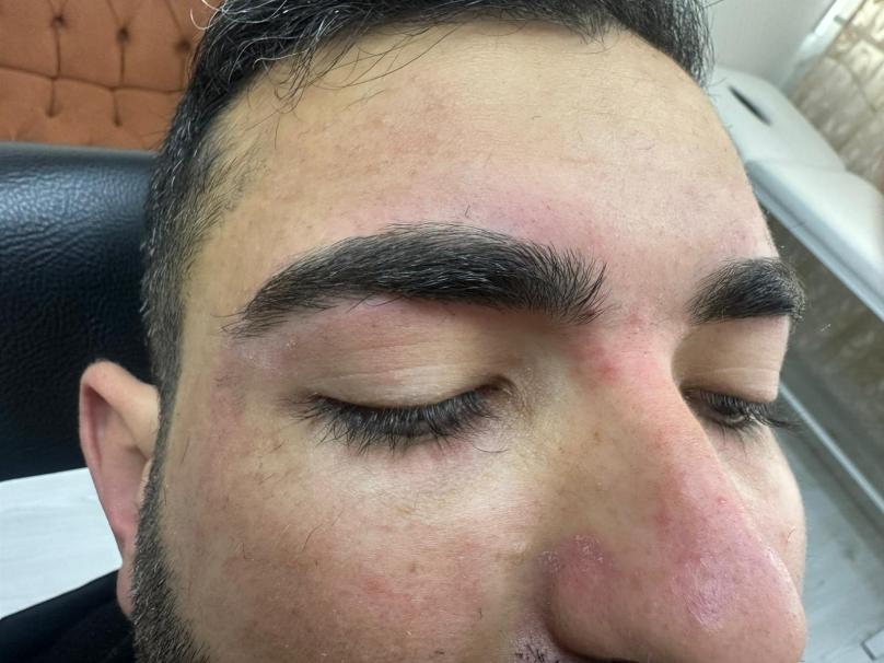 G5 Masajı & Bölgesel İncelme